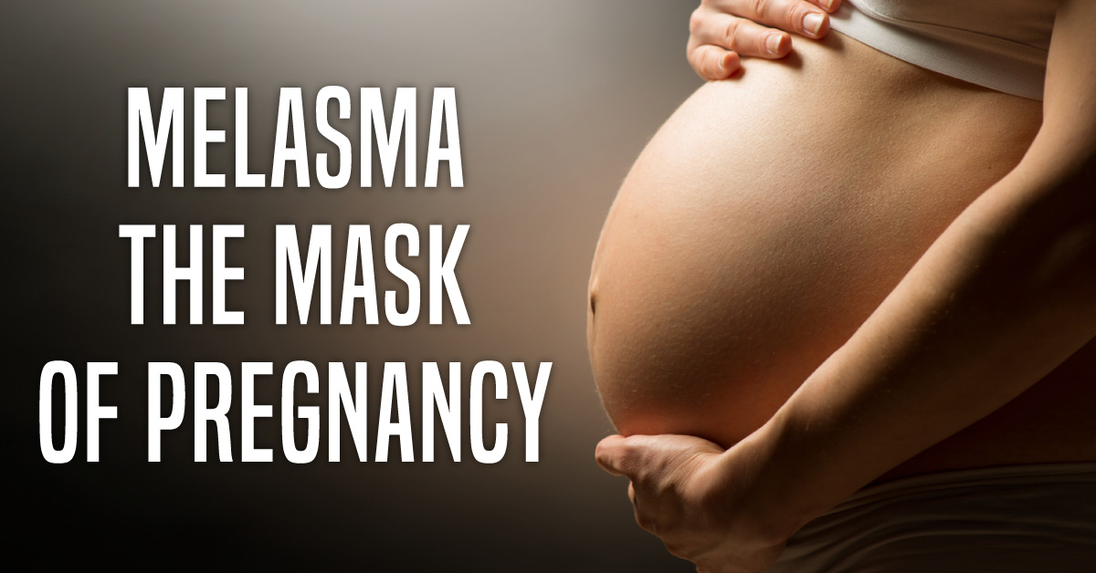 Melasma: A Cosmetic Stigma in Pregnancy