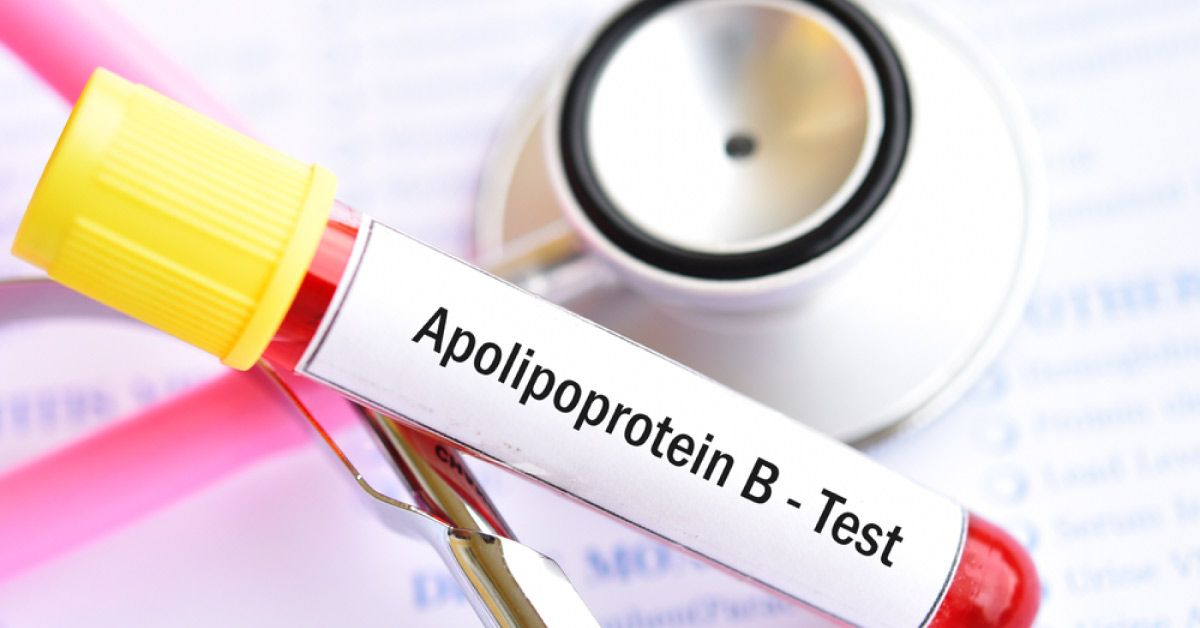 Is it Time to Retire the Conventional Cholesterol Tests?