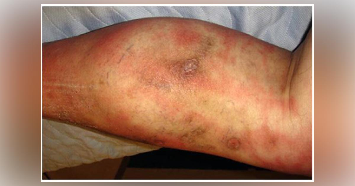 What's the Diagnosis?