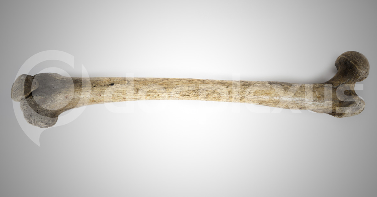 Forensic research updates:  A new method to determine age of deceased more accurately than existing ones