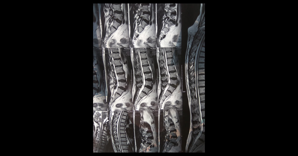Diagnose The Pain In Elderly Male