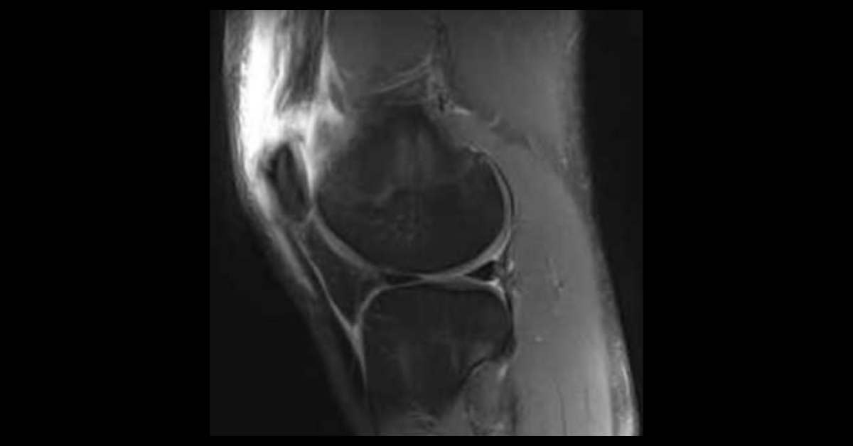 Identify The Injury Of This Young Basketball Player
