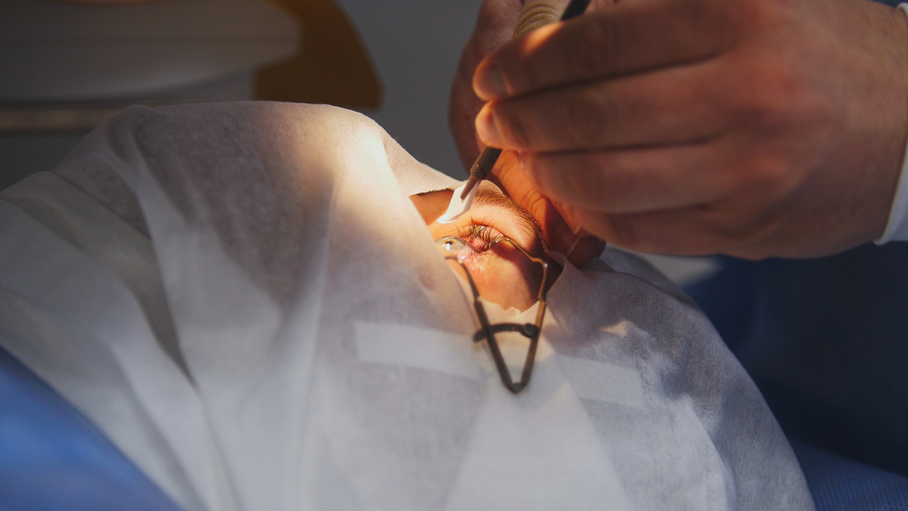 Children With Ophthalmic Problems Examination Under Anesthesia