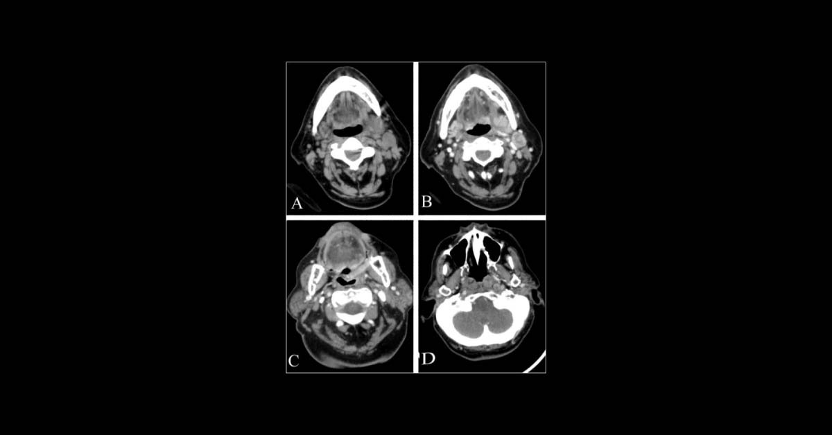 Diagnose This Case of Radiology