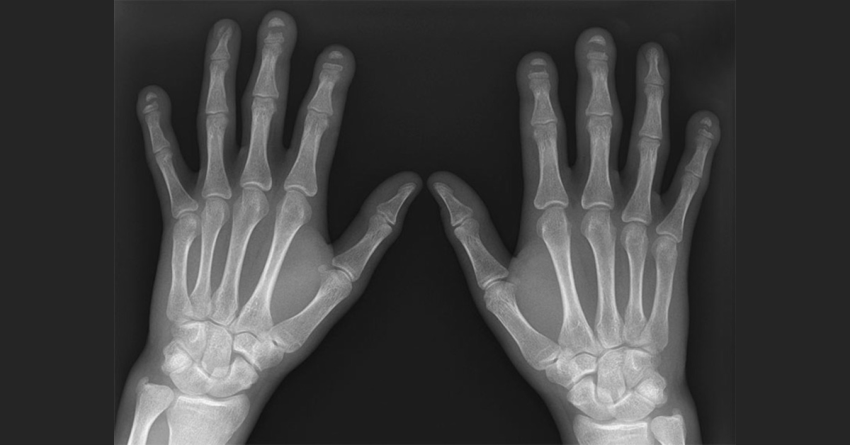 Can You Interpret This Radiograph?