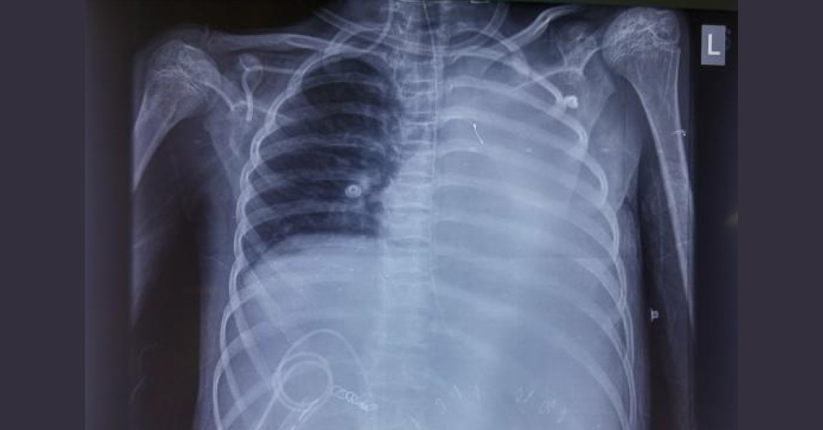 Diagnose This Case