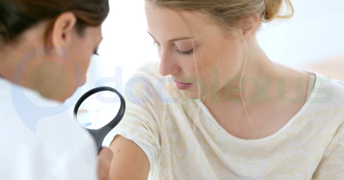 Bacteria Present on Skin Provides Protection from Neoplasia