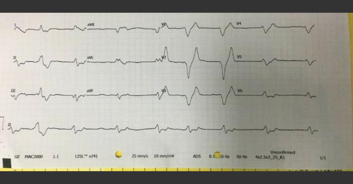 Diagnose This ECG