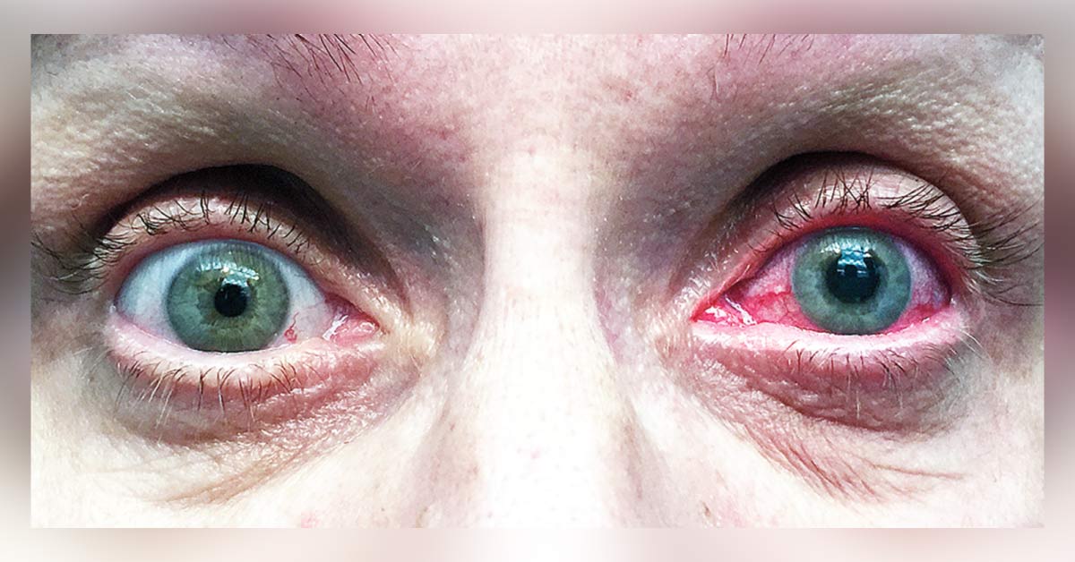 What is the Most Likely Diagnosis for This Woman?