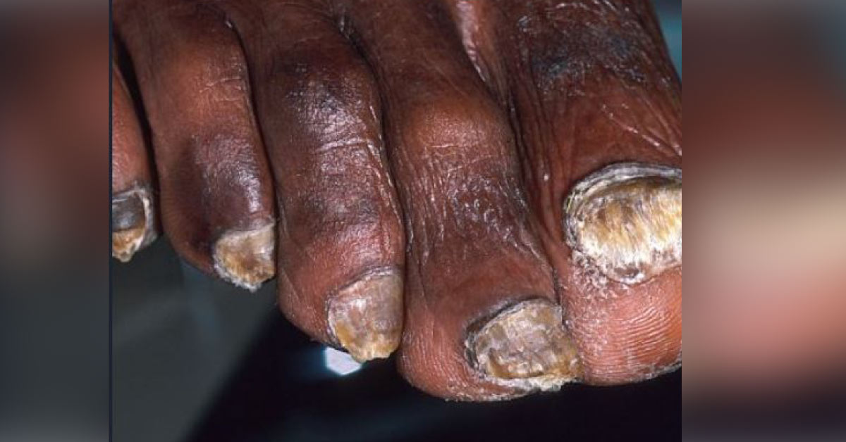 Identify This Infectious Condition