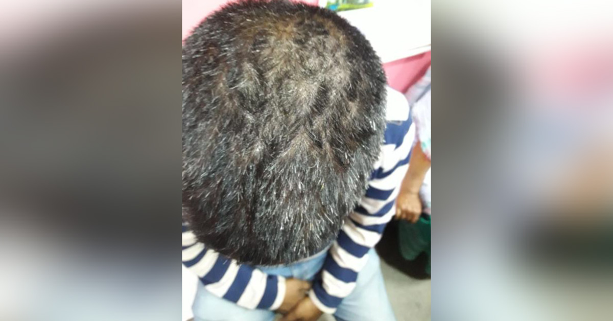Diagnose This Derma Condition