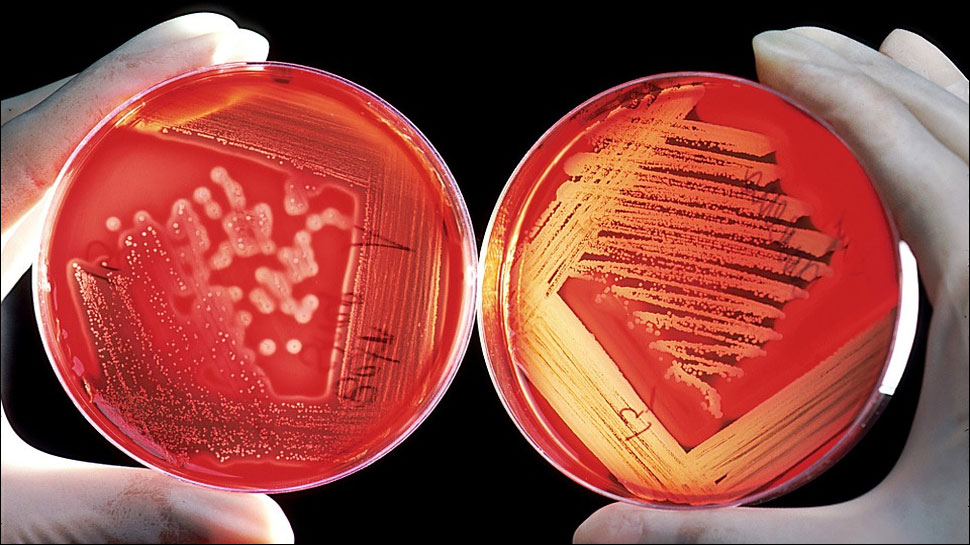 'Disease X' Added To List Of Potential Pandemic Killers By WHO