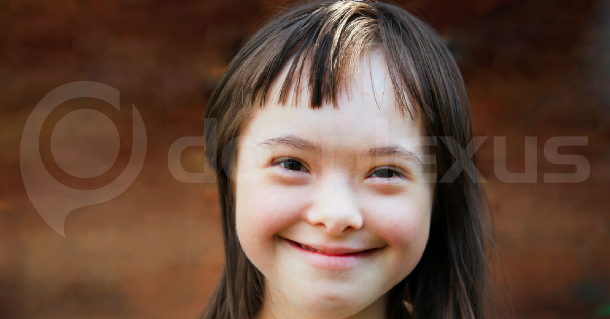 Brief Review Of Downs Syndrome