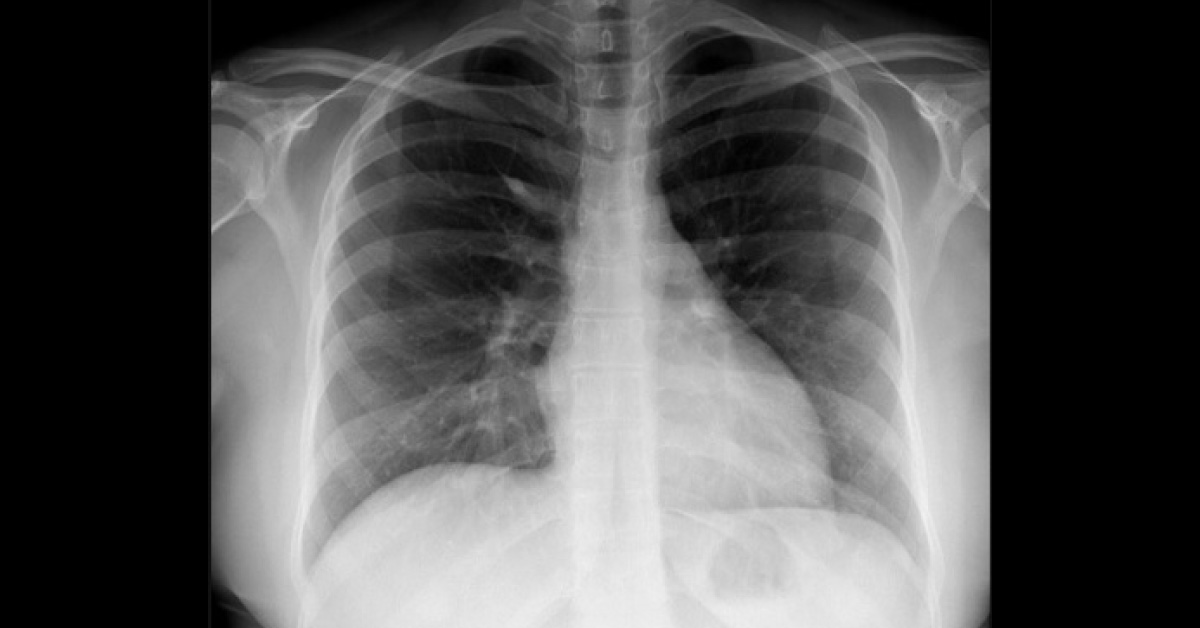 What Does the X-Ray Reveal?