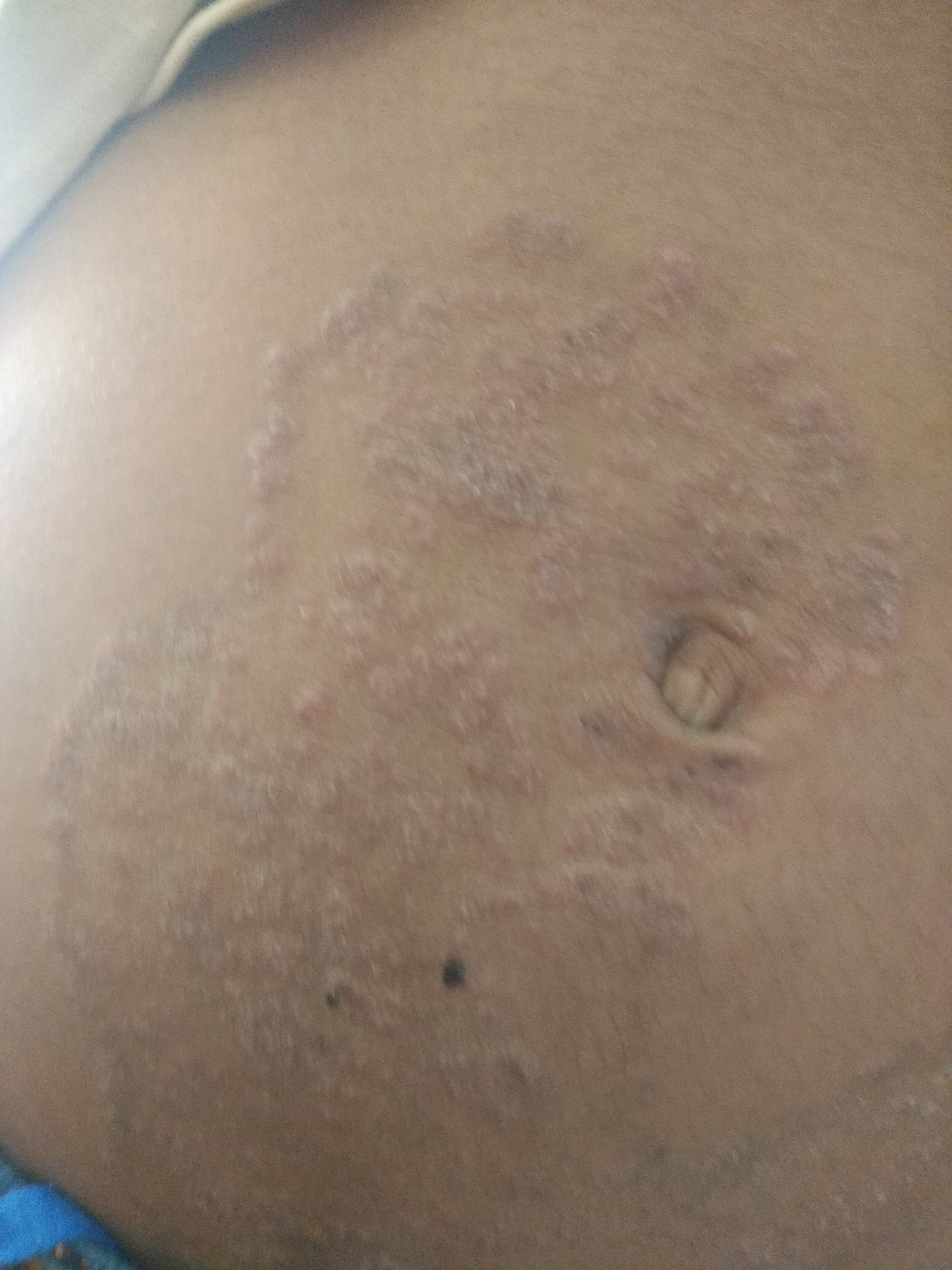 Diagnose This Dermatology Case