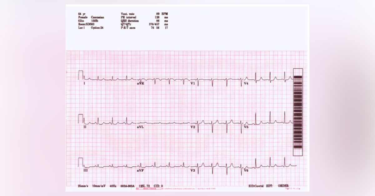 Can You Interpret This ECG?