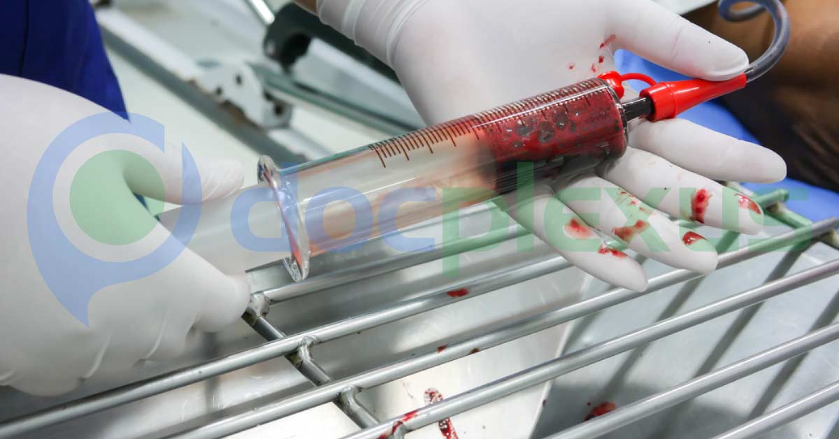 A Patient with GI Bleeding