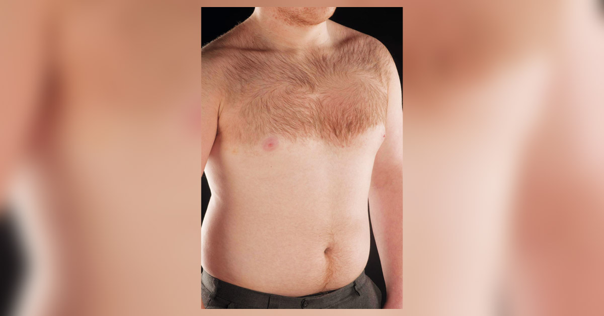 Identify This Condition