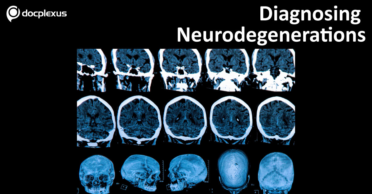 Major Depression And Neurodegenerative Disorder