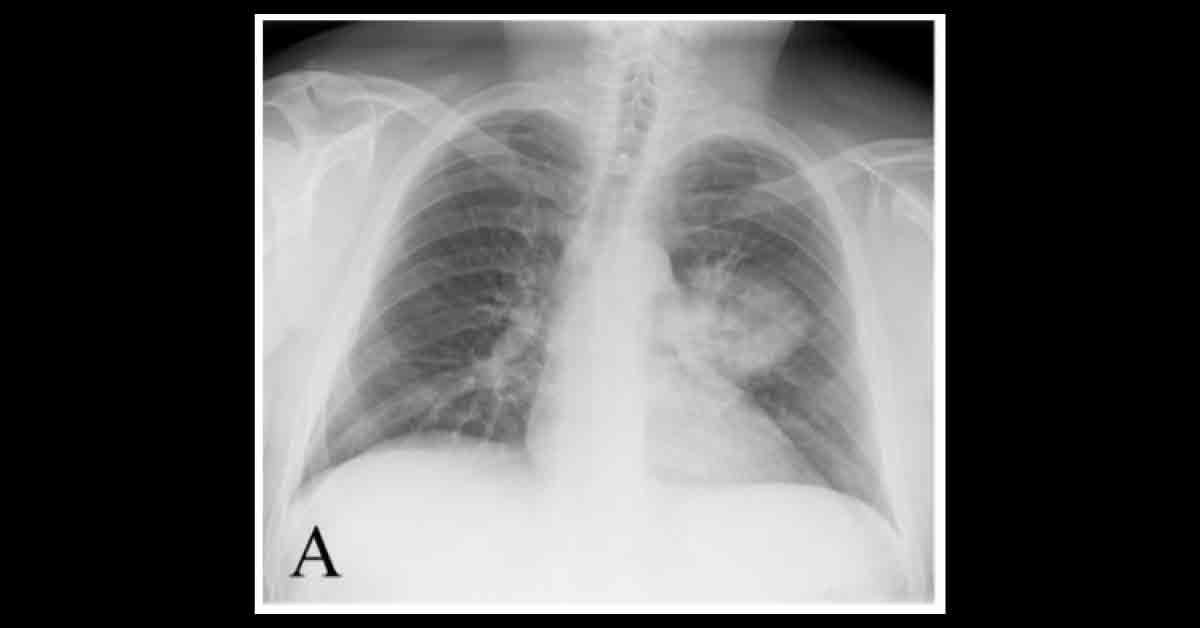 Spot The Diagnosis