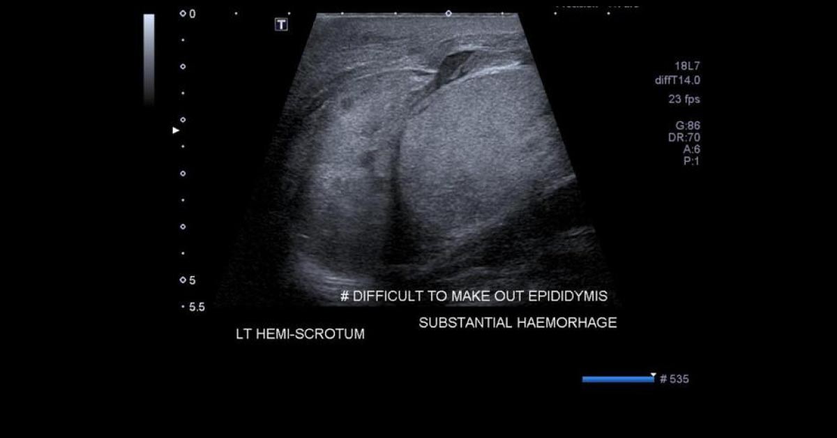 Spot the Abnormality