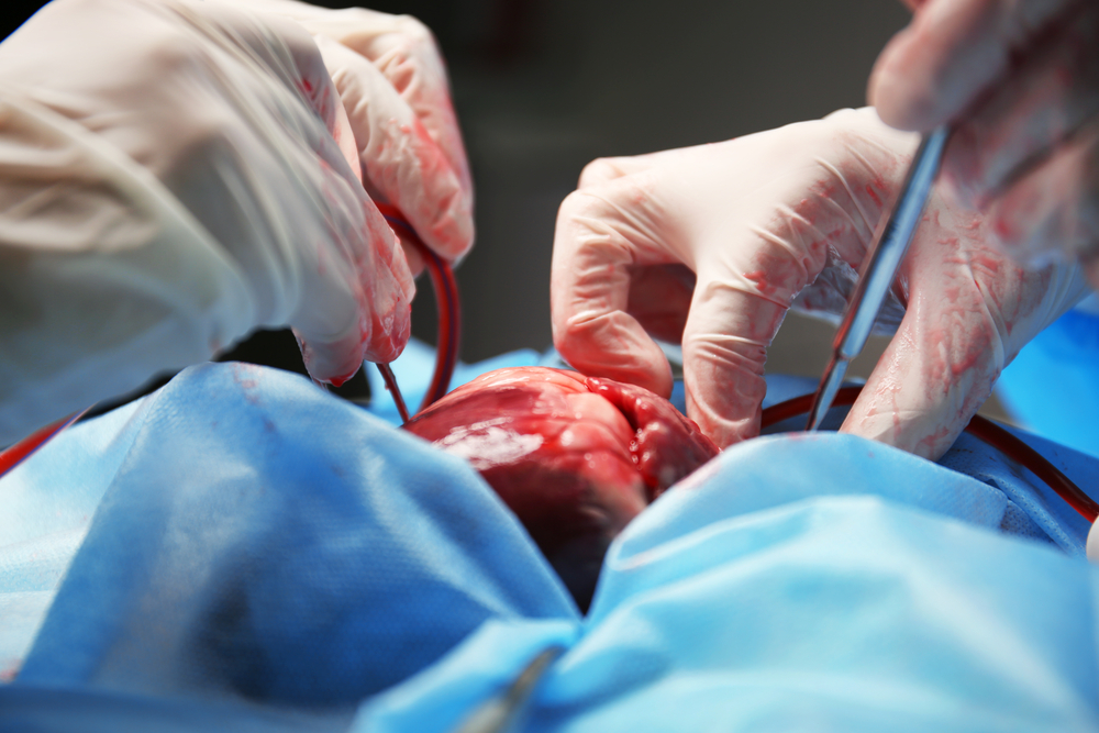 Indications For Surgery For Valve Diseases - Simplified