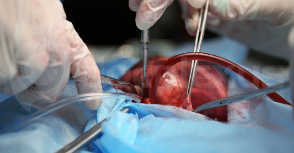 How Will You Mange This Neonate?