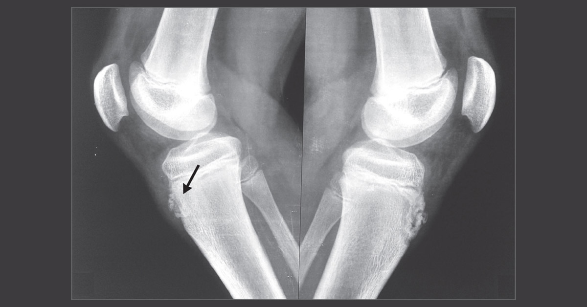 Identify The Disease