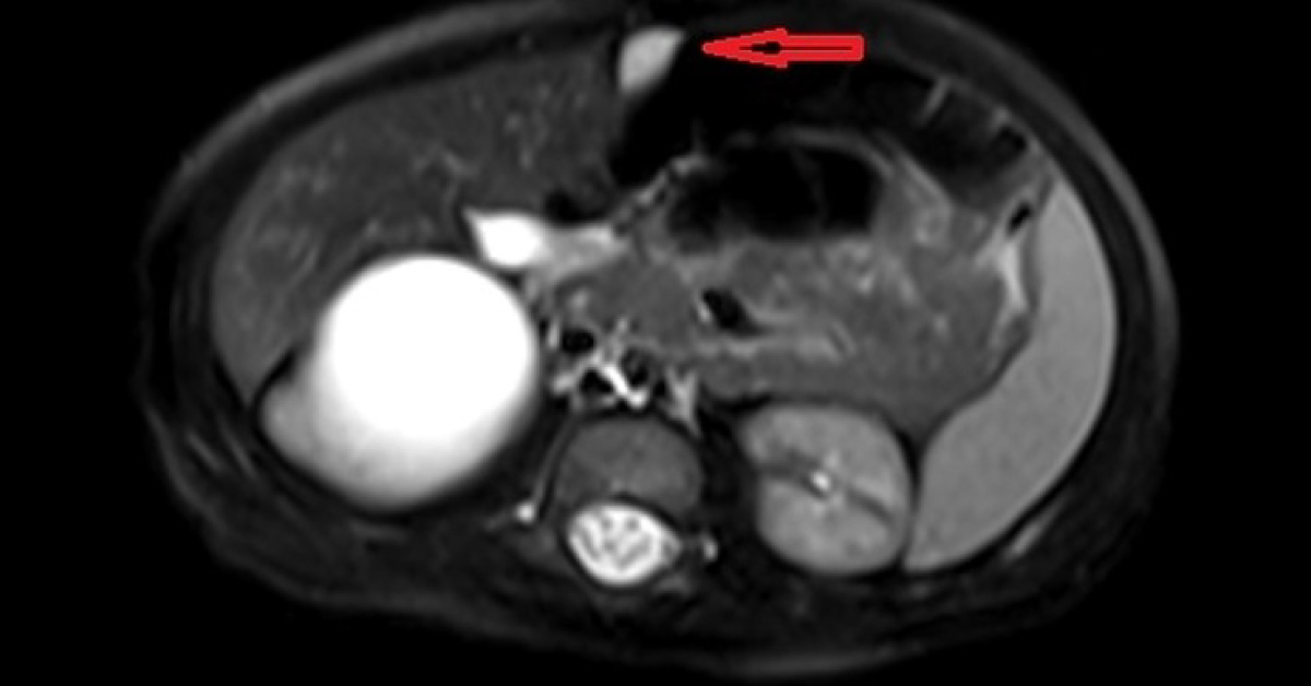 Interpret These Radiological Findings