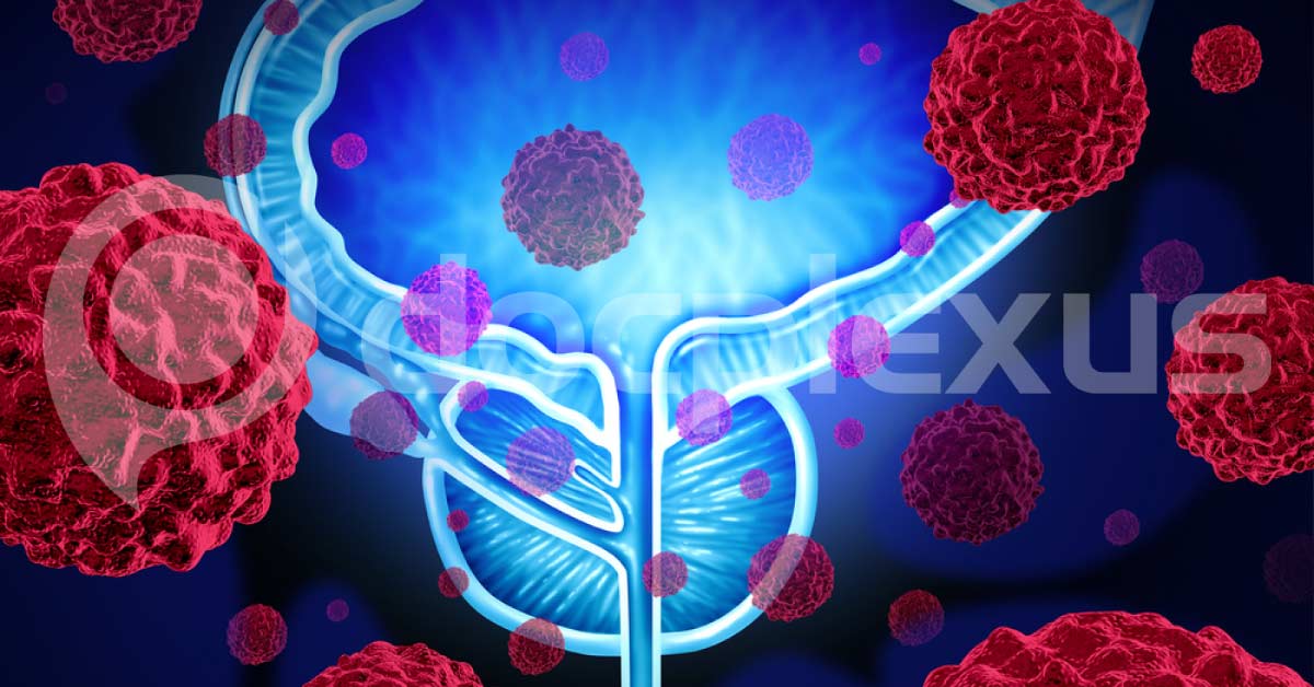 Apalutamide: A Newly Approved Treatment For Prostate Cancer