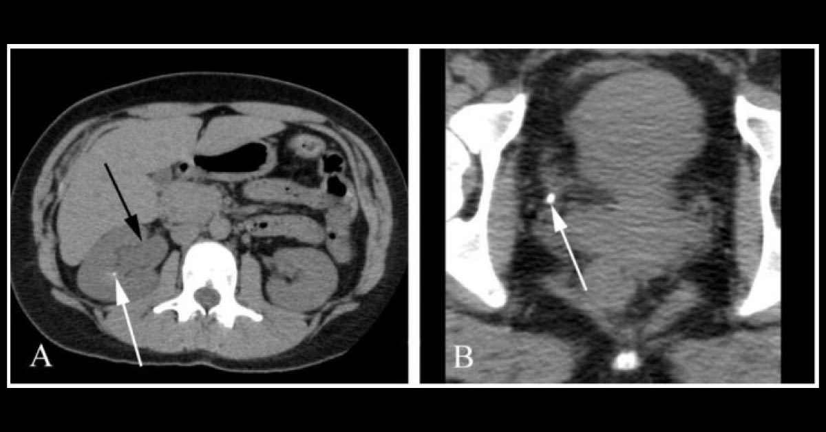 Can You Diagnose This Case Based on Radiological Evidence?