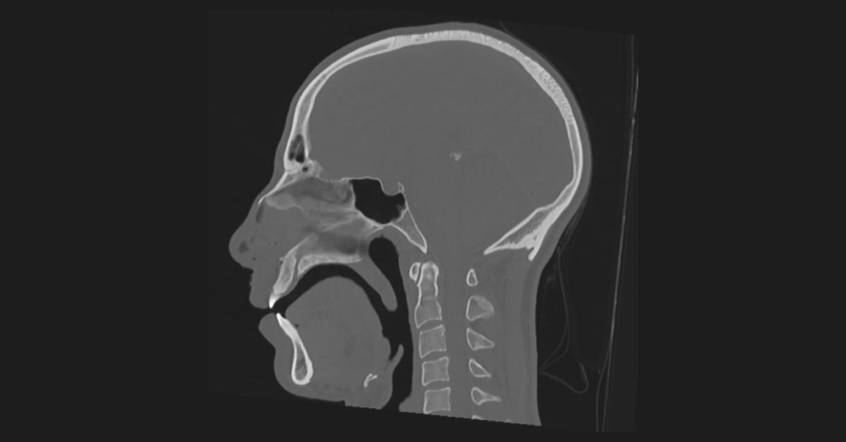 Identify The Injury
