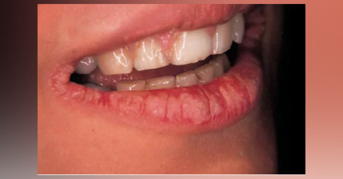 Identify the Condition