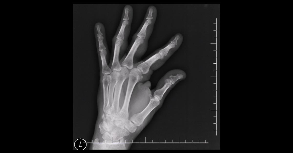 Can You Ace This Case?