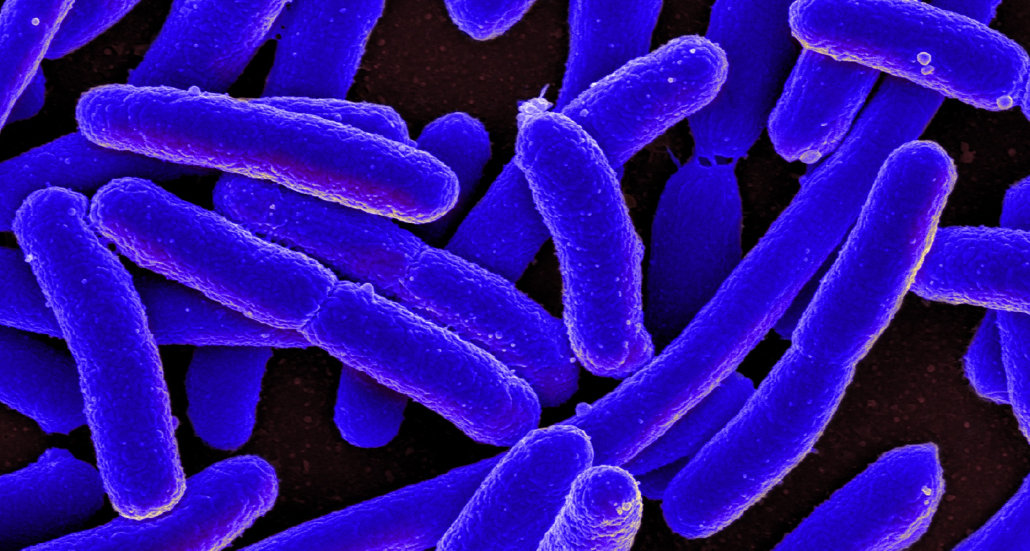 Identify The Bacteria That Infected This Doctor