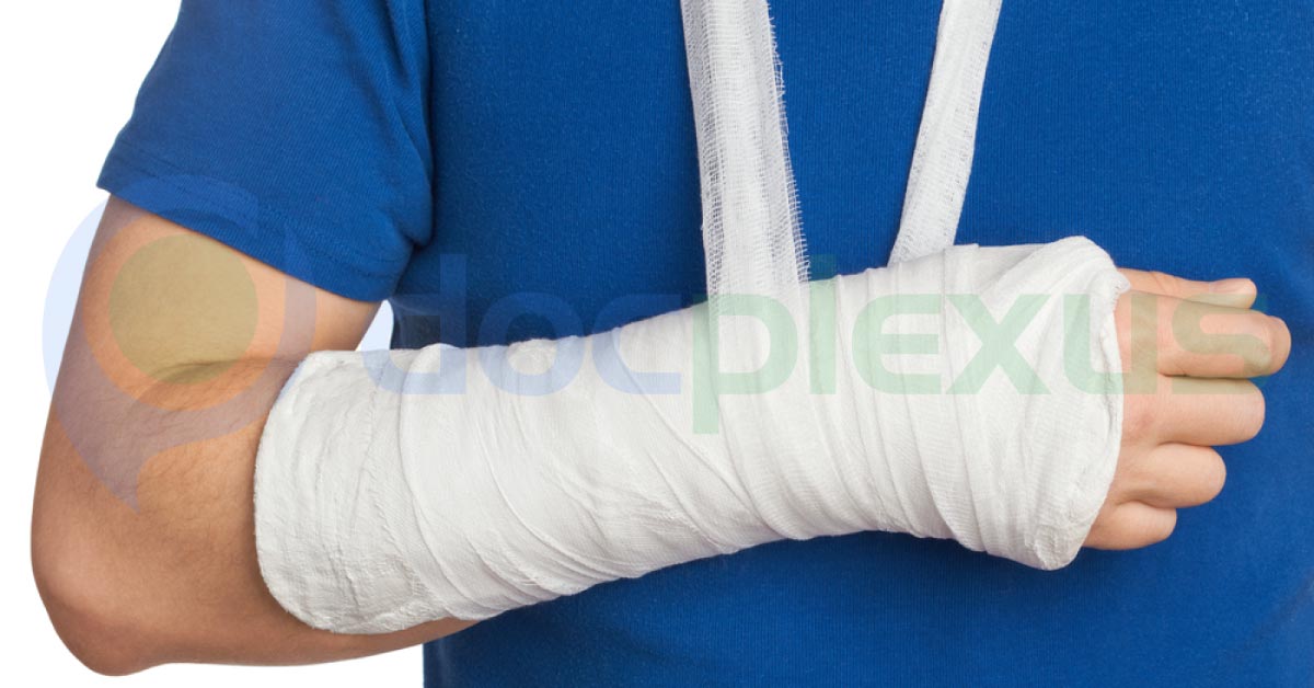 New Adhesive For Faster Bone Fracture Healing