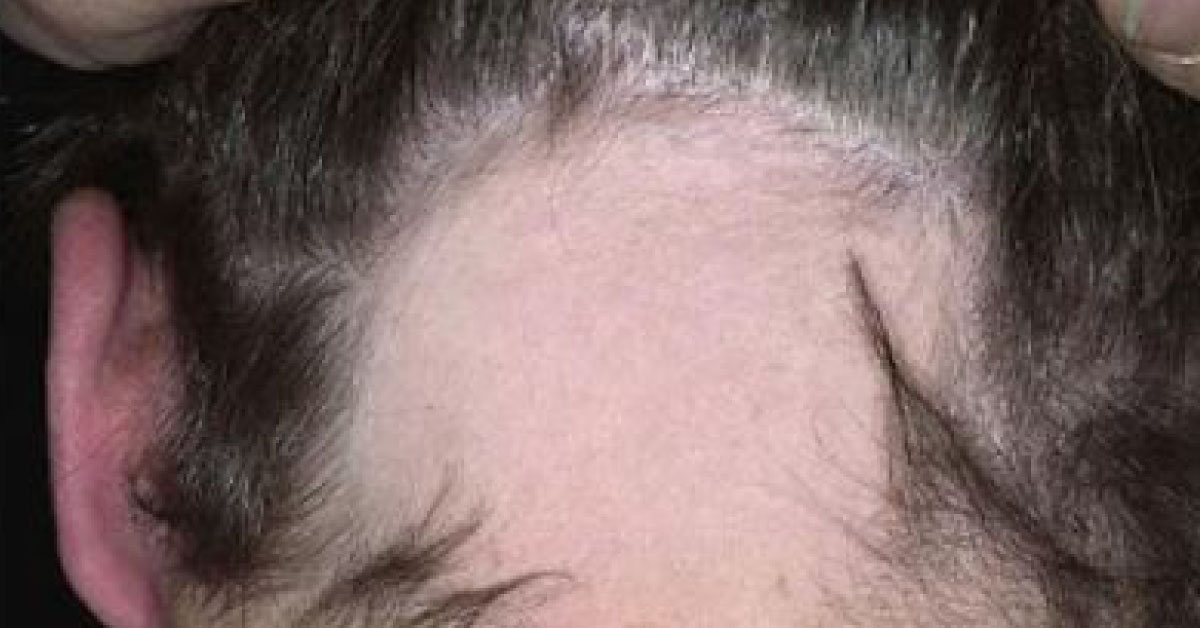Spot The Diagnosis