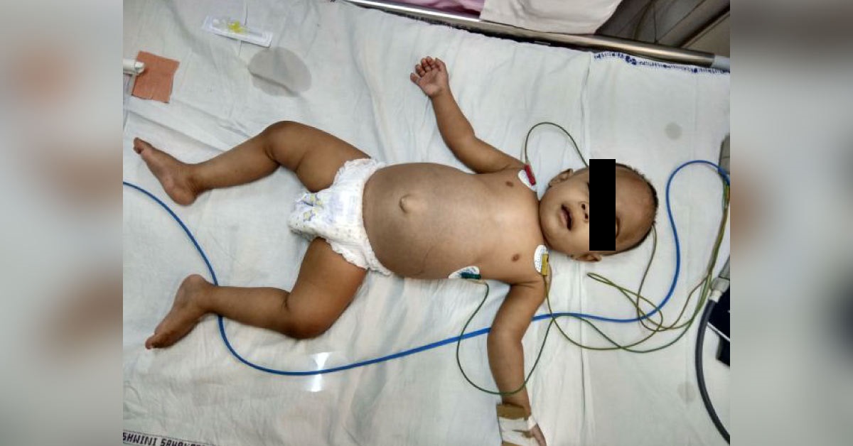 Case Of Cough In Child