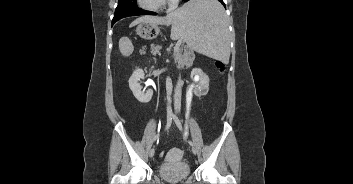 Diagnose This Urology Case?
