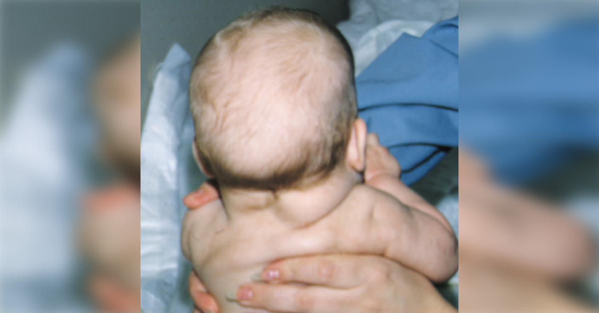 Identify This Condition