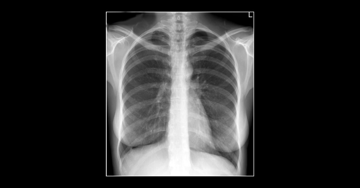 A Women Suffering From A Chest Pain