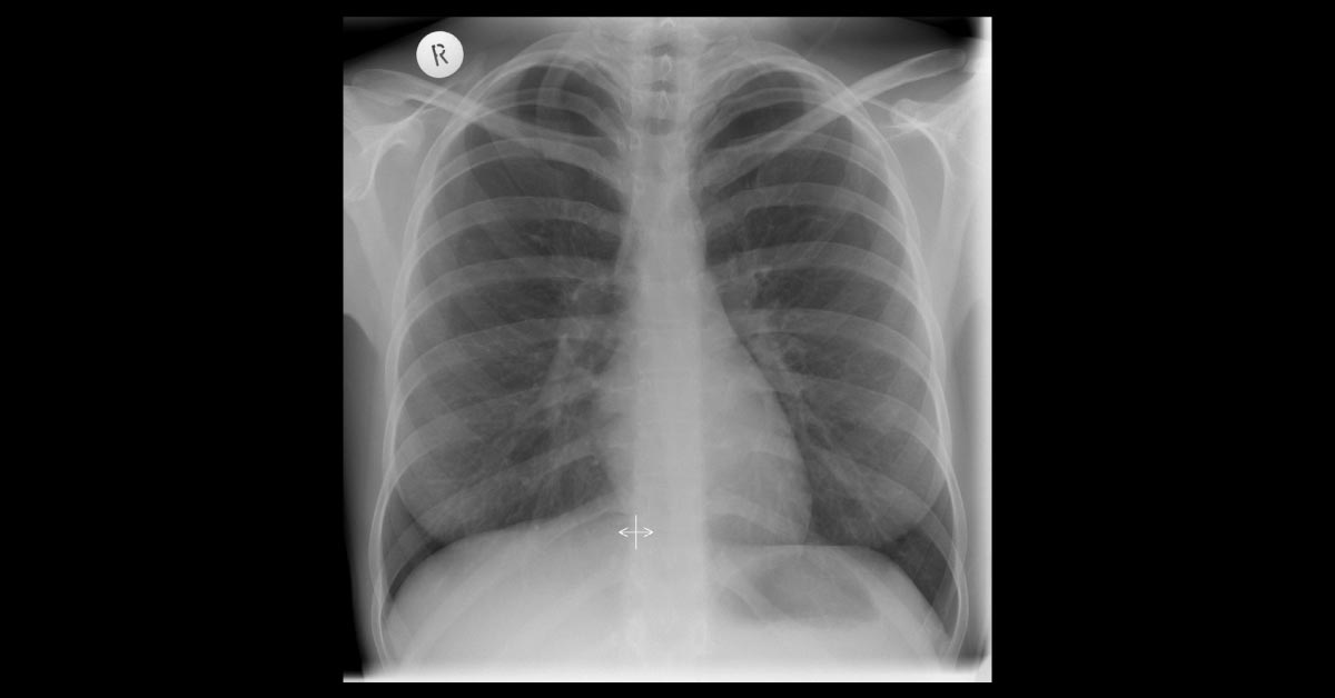 Spot The Diagnosis