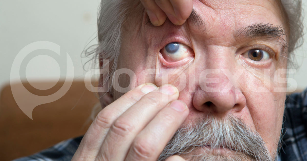 A Man Complaints of Eye Strain Post IOL Implantation - What's Your Diagnosis?