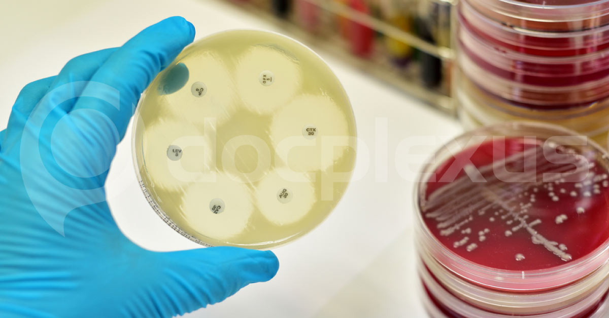 Antimicrobial Resistance: Need for Novel Strategies