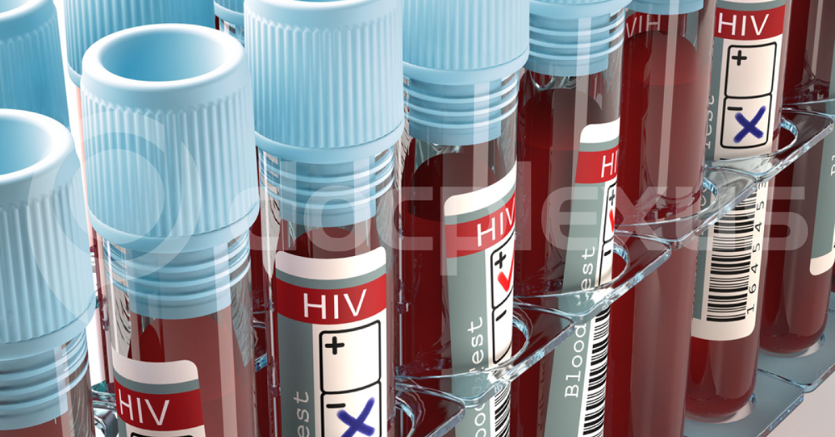 Vaginal Implant Developed To Prevent HIV Infection During Sex