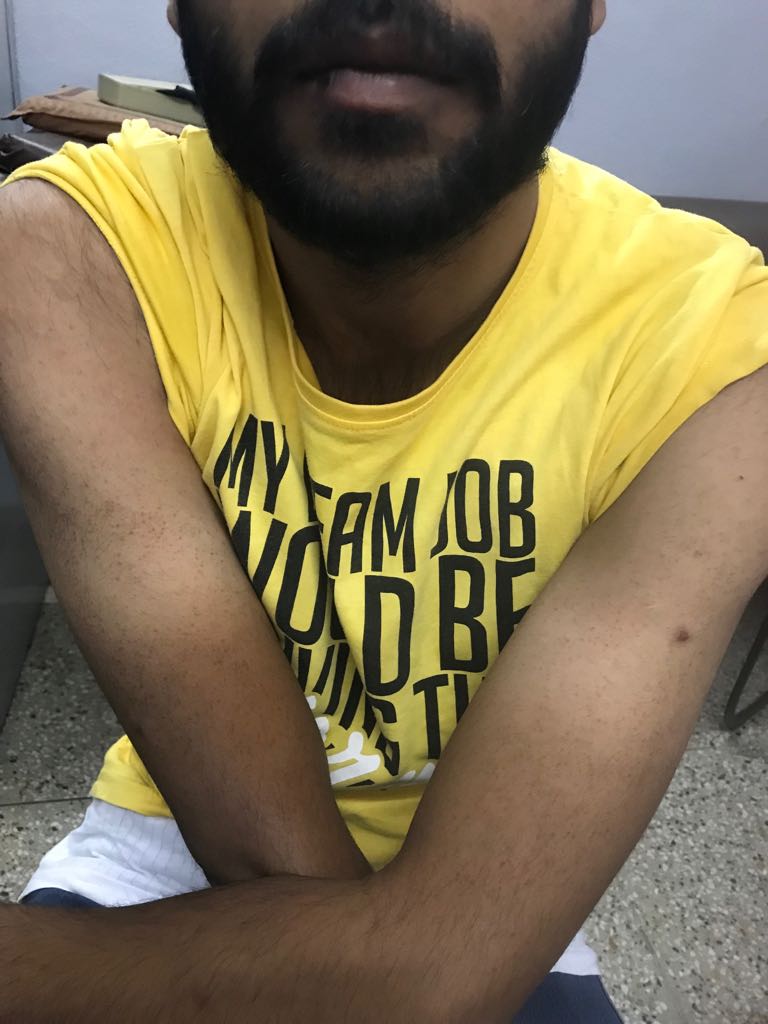 What Are These Black Lesions On Skin Of Boy? 