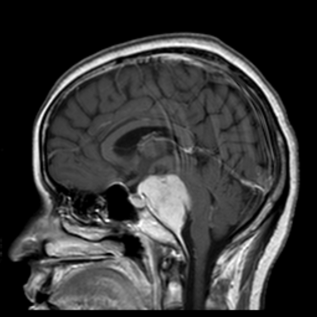 Intrepret The MRI Scan
