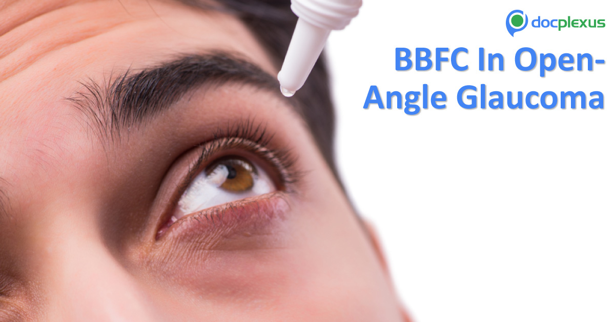 Open-Angle Glaucoma: Brinzolamide/Brimonidine Fixed Combination