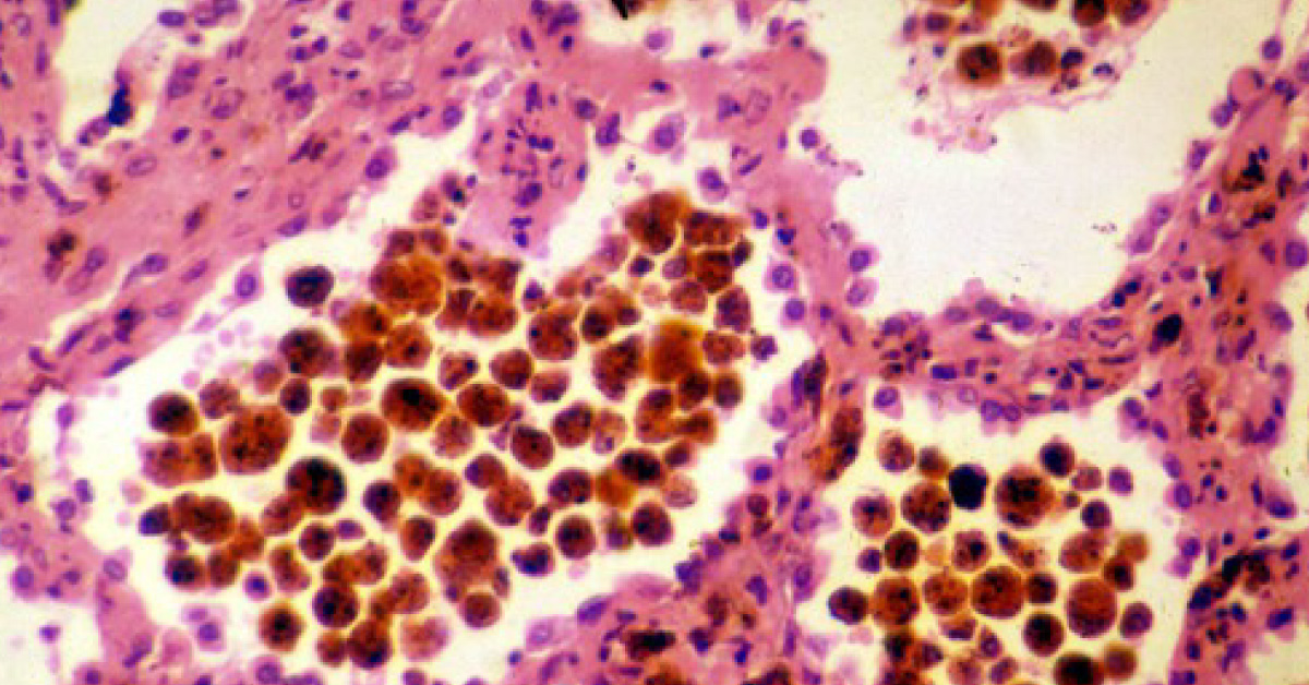 Identify The Underlying Condition