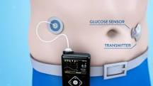 Artificial Pancreas Is A Safe And Effective Treatment For Type 1 Diabetes